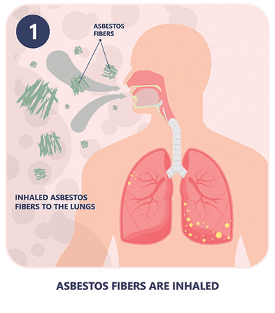 how mesothelioma happens part 1