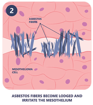 how mesothelioma happens part 2